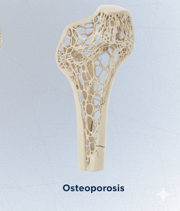 Densitometría ósea.